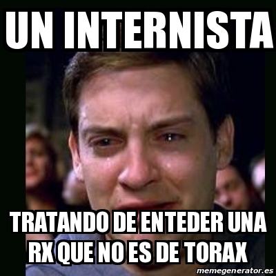 Meme crying peter parker - un internista tratando de enteder una rx que ...